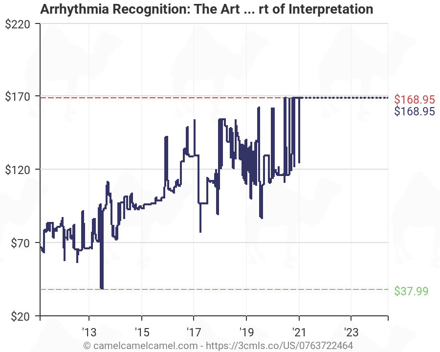 Arrhythmia Recognition Chart